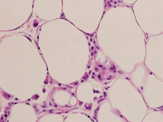 0218 10 tosiasiaa kehon painosta