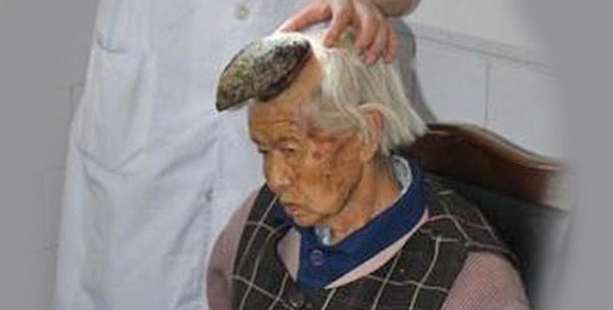 Ja pään sarvet kasvavat naisilla