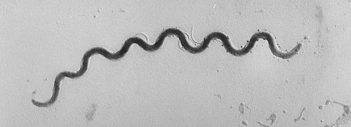 Amerikan on oltava vastuussa Guatemalan syfilis-tartunnasta