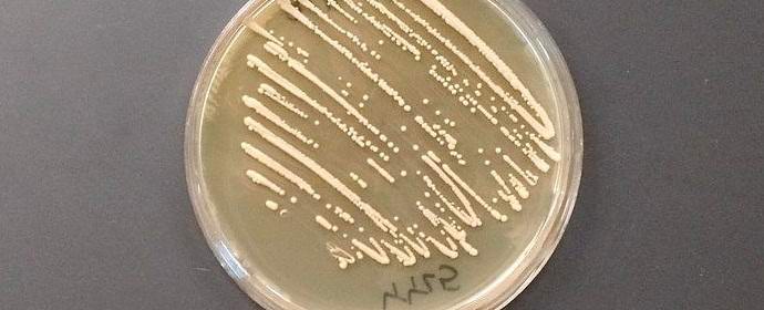 Amerikkalaiset kasvattivat hiivaa, joka muuttaa sokeria oopiumiksi