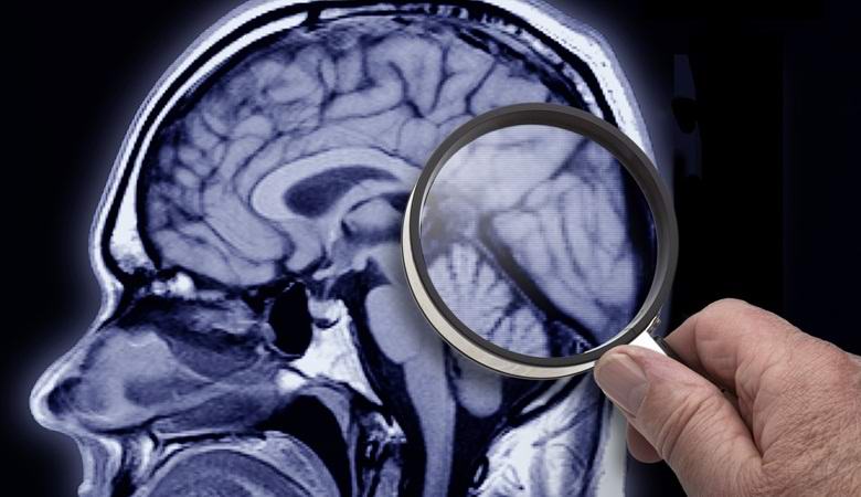 Amerikkalaiset alkavat pian nostaa kuolleita.