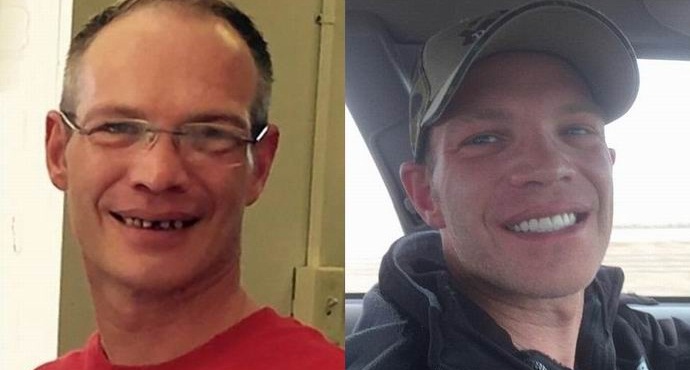 Amerikkalainen jätti tarjoilijan kaksikymmentäviisi tuhatta hammashoitoon