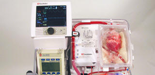 Australialaiset lääkärit ovat oppineet siirtämään kuolleiden sydämien ihmisiä