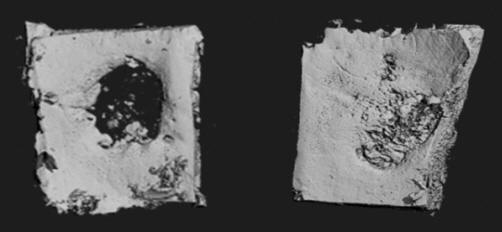 Mahdolliset käyttötarkoitukset-varten-hampaiden-päässä-implantit-to-kallon-virheitä