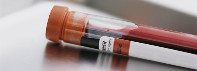 Ihmisellä on kolmekymmentäviisi viittä tunnettua verityyppiä.