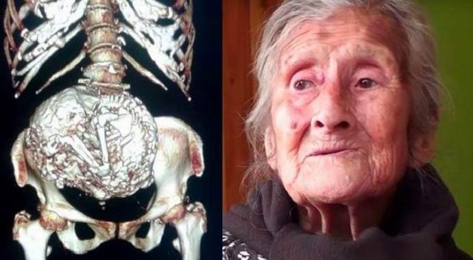 Chileläisellä oli vauva kuuden vuosikymmenen ajan.