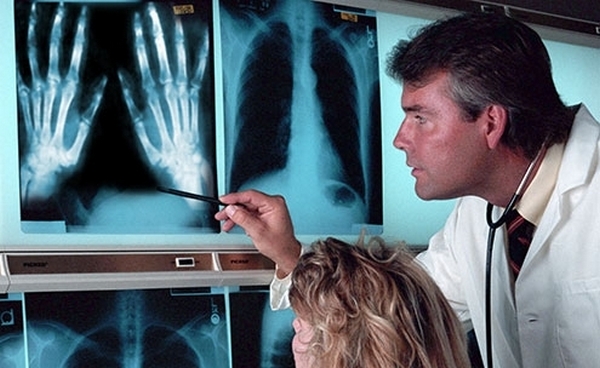 Kymmenen outoja ihmisen sairauksia