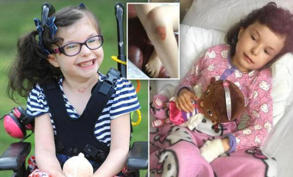 Tyttö, joka ei tunne kipua