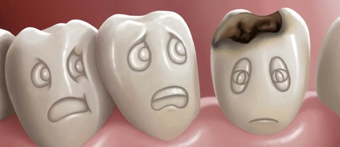 Kaksi ja puoli miljardia maanpäällistä ei halua hoitaa kariesta