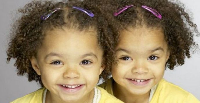 Nämä uskomattomat ja salaperäiset kaksoset!