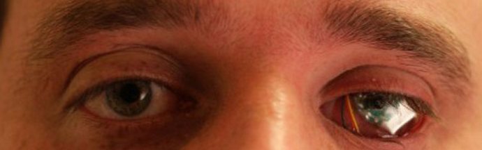 Ja keksit enemmän ja täydellisempiä ... kainalosauvoja