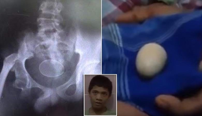 Indonesian munivien teini-ikäisten yllättynyt lääkäri