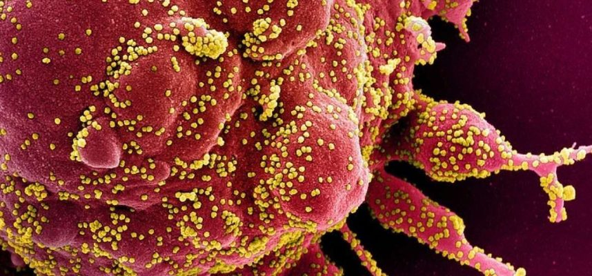 Tutkimus osoittaa, että COVID-19 voi pakottaa immuunijärjestelmät hyökkäämään itseensä 