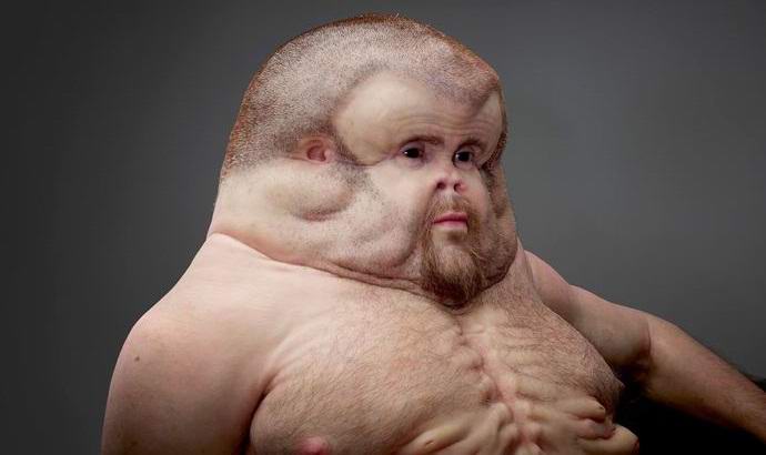 Miltä ihminen, joka kykenee selviämään vakavissa onnettomuuksissa, näyttää?