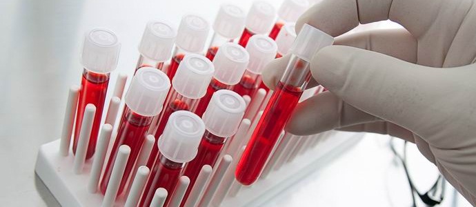 Kanadalaiset voivat tehdä kaikista verityypeistä yhteensopivia.