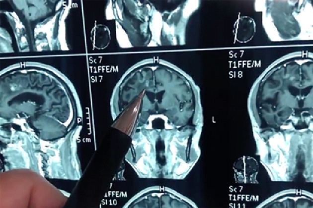 Kiinalainen mies asui 30 vuotta valtavan madon päässä.