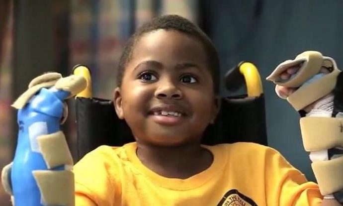 Poika sai kätensä takaisin