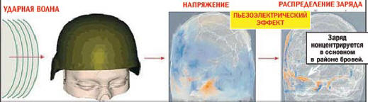 Maksu on keskittynyt pääosin kulmakarvojen alueelle.