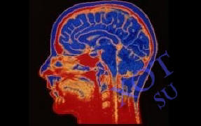 Aivoimplantit auttavat ihmistä työskentelemään tehokkaammin.