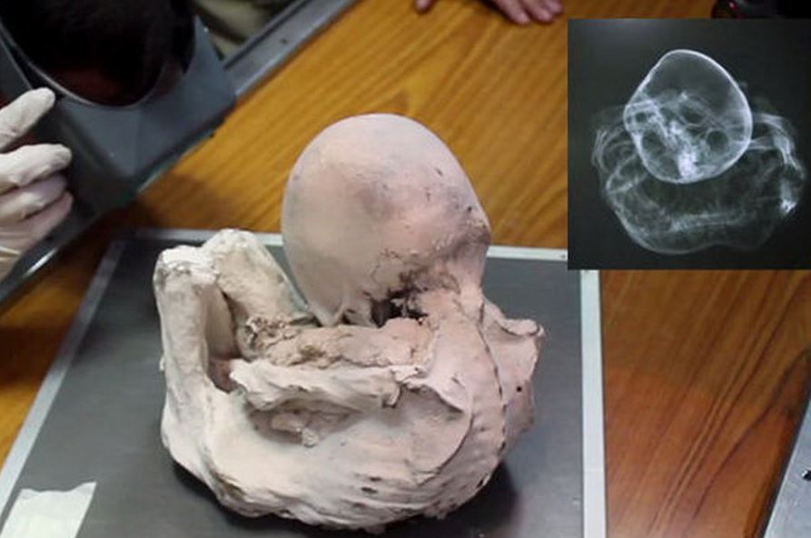 Nazcan muumioita: mitä viides tutkimus osoitti