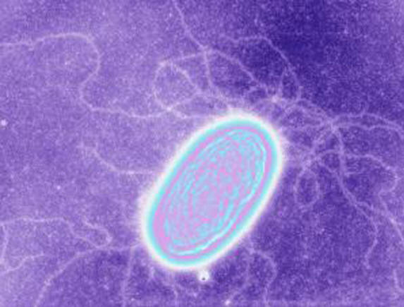 Yksi sähköbakteereista