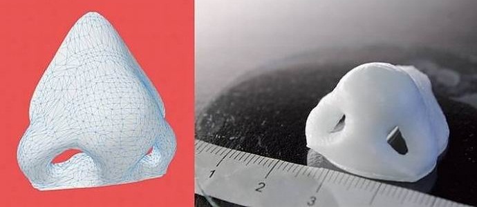 Epätavallinen tulostin luo proteeseja ihmisen kudoksesta