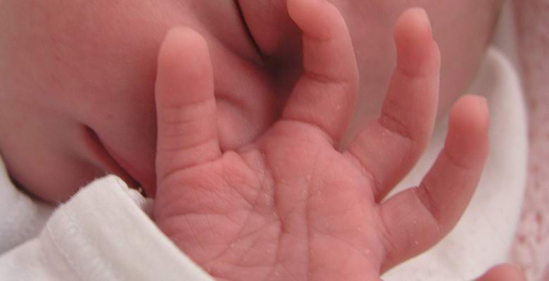 Tietoja thaimaalaisesta tytöstä, joka on syntynyt maskotilla kädessään