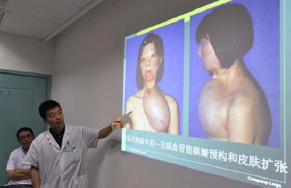 Toinen järkyttävä plastiikkaleikkaus tehtiin Kiinassa.