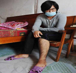 Lääketieteestä nuori kiinalainen nainen on kasvanut hiuksilla