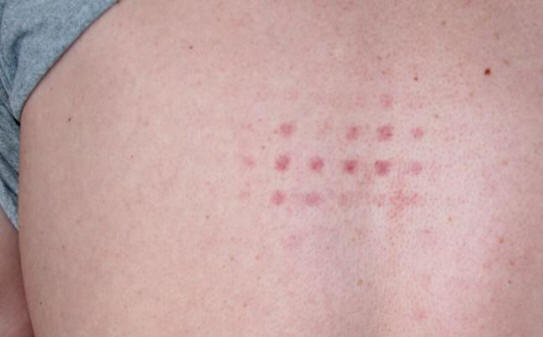 Mistä ruumiin epätavalliset jäljet ​​tulevat?