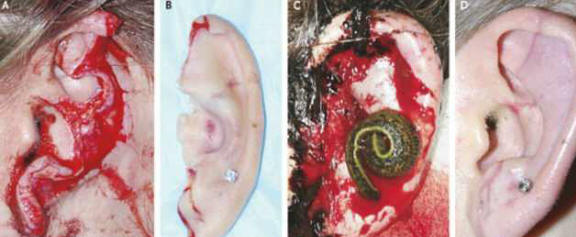 Leikkaukset auttoivat kirurgeja palauttamaan koirin korvan revitty