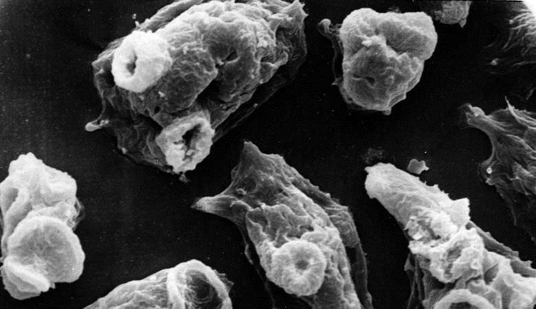 Aivojen syövä ampee toi hurrikaanin IRMA Yhdysvaltoihin