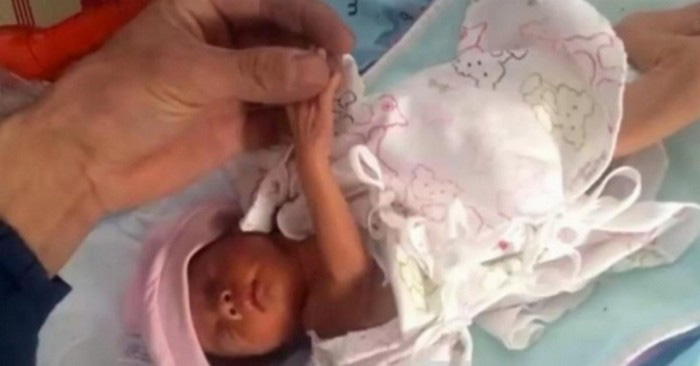 Elossa haudattu tyttö selvisi ihmeellisesti