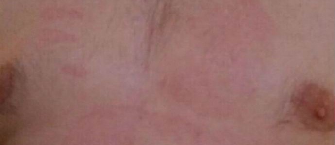 Poltergeistin kämmen poltti Novorossiyskin rinnan