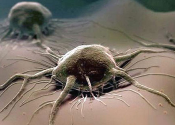 Onko syöpä kuolemaan johtavan onnettomuuden syy?