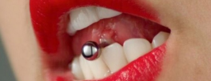 Hän lävisi kielensä - menetti etuhampaat