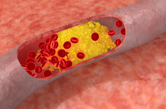 Ihmisten harvinaisten geneettisten mutaatioiden seurauksena hankitut kyvyt