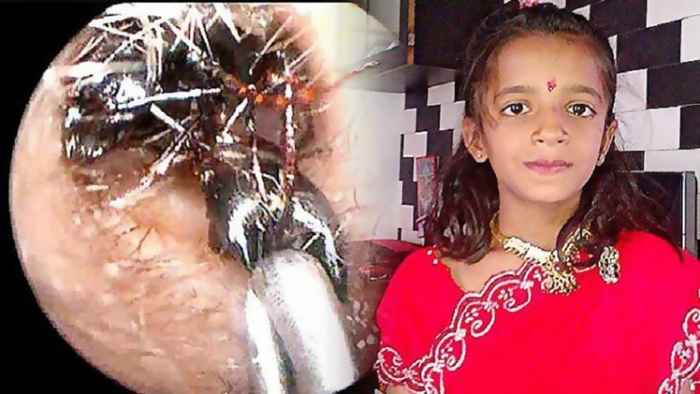 Outoja lääketieteellisiä tapauksia muurahaisten kanssa Intiassa