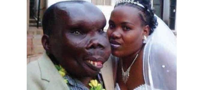 Ugandan rumaimmalla miehellä on kahdeksas lapsi.