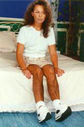 Keksittyjä karvaisia ​​sukkahousuja, joilla on raiskauksen estävä toiminta