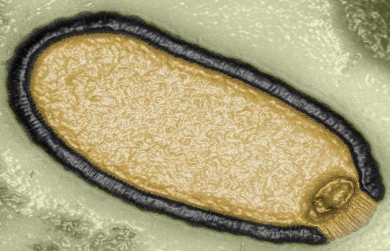 Löytyy Yhdysvaltain metsistä