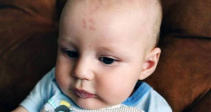 Etelä-Afrikassa poika on merkitty syntymämerkillä - numero kaksitoista