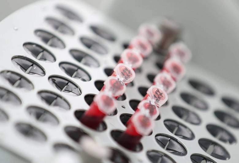 Ranskassa he keksivät, kuinka pistää vaatteita läpi ilman ruiskua