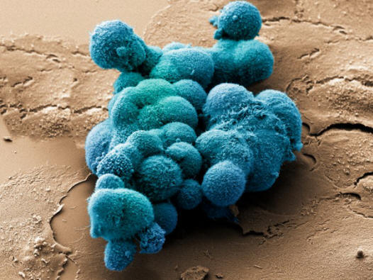 Haimasyöpäsolut, jotka yrittävät muodostaa tilavuusrakennetta. (Photo noindexa target = _blank href = http: //www.corbisimages.comDr. Stanley Flegler / a / noindex.)