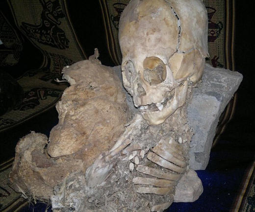 Miksi muinaiset ihmiset muuttivat kallonmuotoaan?