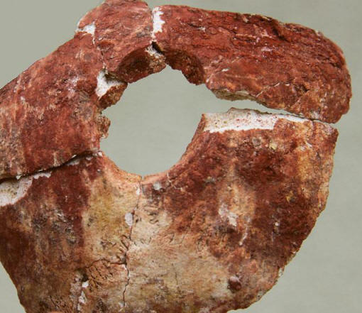 Miksi kuusi tuhatta vuotta sitten kirurgit trepanoivat